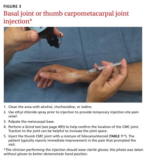 Cpt joint injection. Things To Know About Cpt joint injection. 